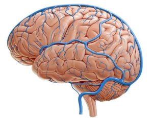 سوال 4 بیماری های مغز و اعصاب آزمون دستیاری پزشکی 1400